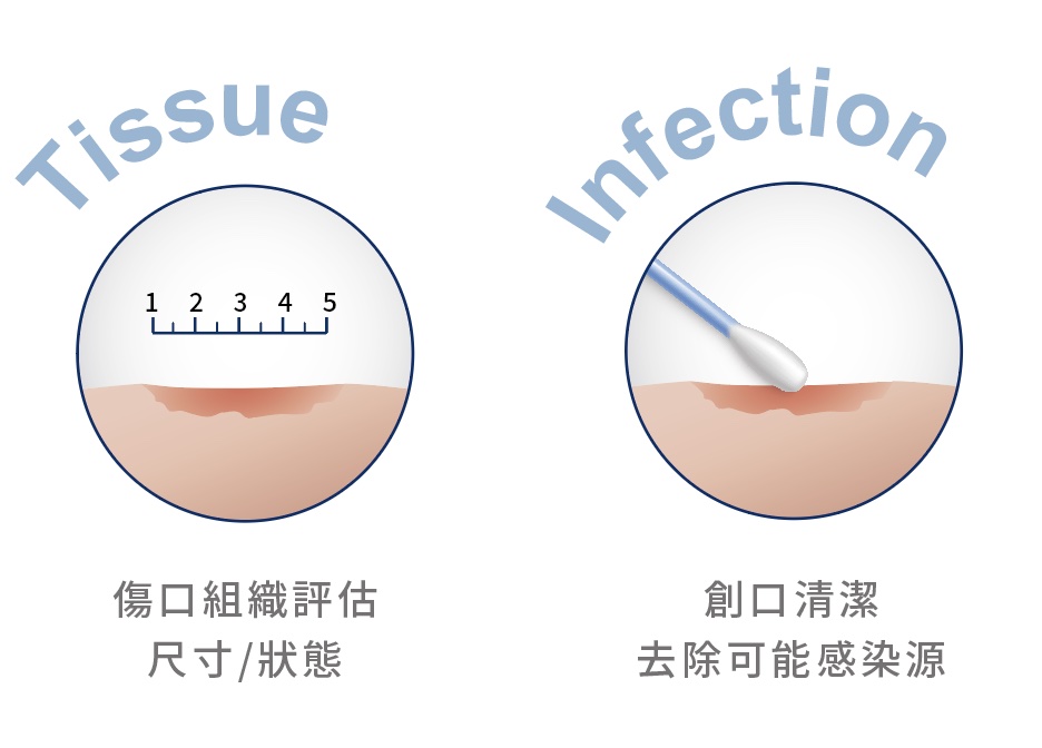 困難傷口照護產品 – TRONJEN