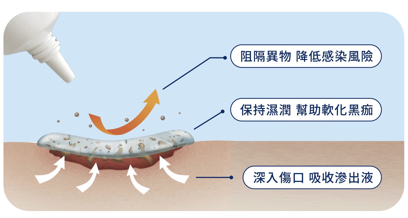 降低感染軟化黑痂吸收滲出液