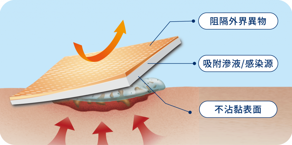 Foam Dressing Product Features 泡棉敷料產品特色